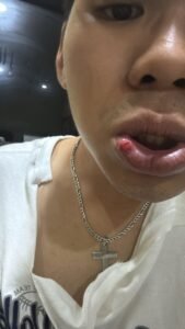 Saksi dan Alat Bukti Lengkap, Ketua SMSI Lampung Desak Polisi Tetapkan Tersangka Penganiayaan di Bandar Lampung