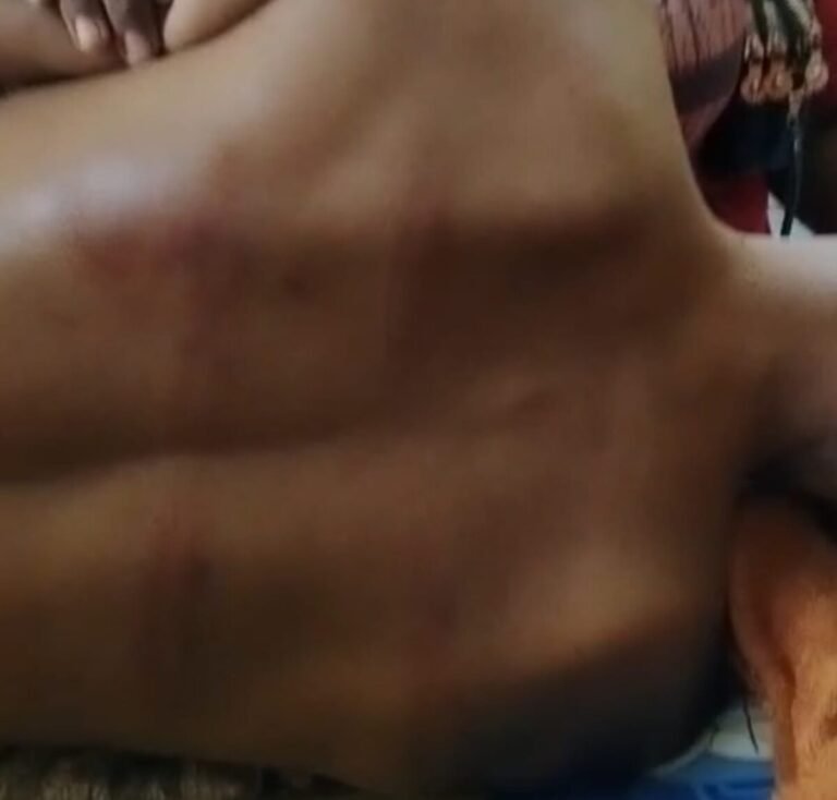 Kejam! Diduga Aniaya Warga Pakai Benda Tumpul, Oknum Polisi Lampura Disebut Lepaskan Dua Tembakan